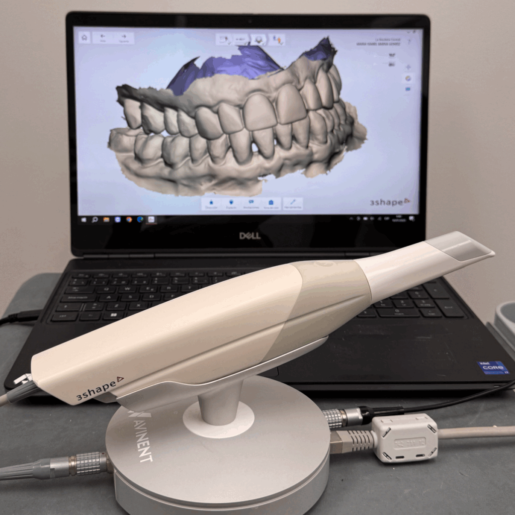 ESCÀNNER INTRAORAL 3D