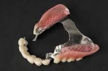 protesis la bordeta dental
